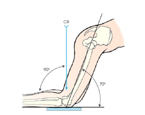 The patient position and central ray shown in this figure will demonstrate the:   A)  patella. B)  patellofemoral joint. C)  intercondylar fossa. D)  tibiofibular joint space.