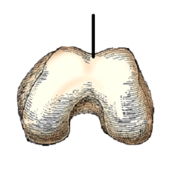 The area identified on this figure is the:   A)  patella surface. B)  intercondylar eminence. C)  intercondylar fossa. D)  tibial tuberosity.