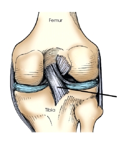 The ligament identified in this figure is the:   A)  posterior cruciate. B)  anterior cruciate. C)  tibial collateral. D)  fibular collateral.
