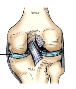 Which part of the knee is identified on this figure?   A)  Medial meniscus B)  Lateral meniscus C)  Tibial collateral ligament D)  Fibular collateral ligament