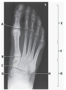 The group of bones labeled as G in the image below are the:   A)  phalanges. B)  metatarsals. C)  digits. D)  tarsals.