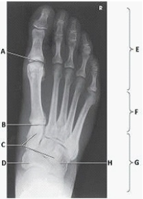 Letter H in the image below labels the:   A)  navicular. B)  cuboid. C)  talus. D)  lateral cuneiform.
