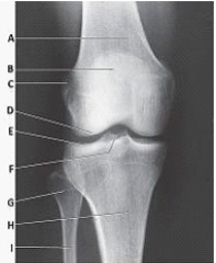 The anatomy labeled with letter F in the image below is the:   A)  tibial tuberosity. B)  intercondylar eminence. C)  medial malleolus. D)  lateral malleolus.