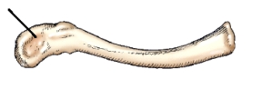 The part identified on the clavicle in this figure is the:   A)  sternal extremity. B)  acromial extremity. C)  inferior angle. D)  subscapular fossa.