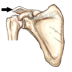 The part identified by the arrow in this figure is the:   A)  acromion. B)  coracoid process. C)  glenoid cavity. D)  superior border.