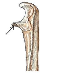 The bone part labeled with the arrow in this figure is the:   A)  radial notch. B)  trochlear notch. C)  coronoid process. D)  olecranon process.