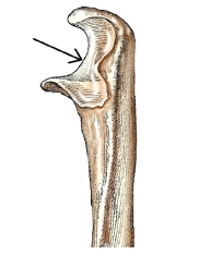 The area on the bone labeled with the arrow is this figure is the:   A)  radial notch. B)  trochlear notch. C)  coronoid process. D)  olecranon process.