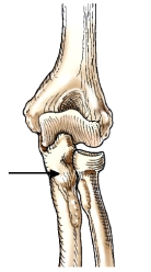 The bone indicated by the arrow in this figure is the:   A)  ulna. B)  radius. C)  tibia. D)  humerus.
