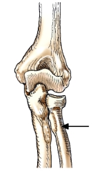 The bone identified by the arrow in this figure is the:   A)  ulna. B)  radius. C)  fibula. D)  humerus.