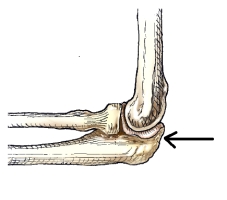 The bone part identified by the arrow in this figure is the:   A)  trochlea. B)  capitulum. C)  radial head. D)  olecranon process.