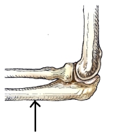 The bone or bone part identified by the arrow in this figure is the:   A)  ulna. B)  radius. C)  humerus. D)  olecranon process.