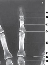 What anatomy of the third digit is labeled as letter C in the figure above?   A)  Distal phalanx B)  Proximal phalanx C)  Middle phalanx D)  Metacarpal