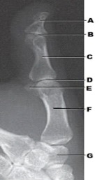 Which portion of the first digit is labeled as letter C in the figure above?   A)  Proximal phalanx B)  Middle phalanx C)  Distal phalanx D)  Metacarpal