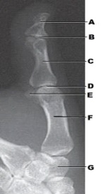 Which bone is labeled as letter G in the figure above?   A)  Scaphoid B)  Pisiform C)  Sesamoid D)  Trapezium