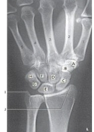 Letter J in the figure above labels the:   A)  radial styloid. B)  ulnar styloid. C)  humeral styloid. D)  radial head.