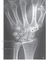 In the figure above,the hamate is labeled as letter:   A)  D. B)  F. C)  G. D)  H.