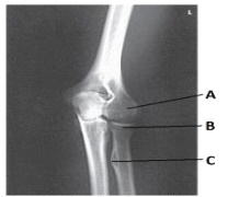 Letter B in the image below labels the:   A)  medial epicondyle of the humerus. B)  capitulum. C)  radial head. D)  trochlea.