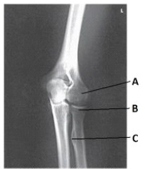 Letter C in the image below labels the:   A)  radial tuberosity. B)  capitulum. C)  radial head. D)  trochlea.