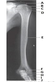 What anatomy is labeled as letter B in the image below?   A)  Greater tubercle B)  Lesser tubercle C)  Humeral head D)  Glenoid