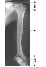 What projection and anatomy is demonstrated in the image below?   A)  AP forearm B)  AP humerus C)  Lateral forearm D)  Lateral humerus
