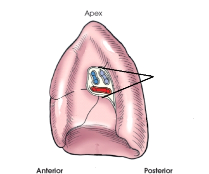 The area identified in this figure is the:   A)  hilum. B)  lingula. C)  mediastinum. D)  pulmonary veins.