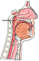 The anatomy identified on the lateral neck above is the:   A)  oropharynx. B)  nasopharynx. C)  soft palate. D)  epiglottis.