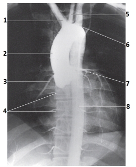 The artery labeled 6 in this figure is the _____ artery.   A)  brachiocephalic B)  left common carotid C)  left subclavian D)  left coronary