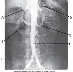 Letter A in the abdominal aortogram image below is the _____ artery.   A)  splenic B)  celiac C)  R renal D)  hepatic