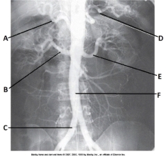 Letter E in the abdominal aortogram image below is the _____ artery.   A)  hepatic B)  splenic C)  L renal D)  superior mesenteric