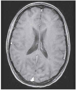 Study this image.Identify the imaging plane and modality.   A)  MRI,sagittal B)  CT,sagittal C)  MRI,axial D)  CT,axial