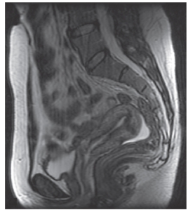 <strong>Identify the imaging plane,anatomy,and modality in this figure. </strong> A) Midcoronal CT,female pelvis B) Midcoronal CT,male pelvis C) Midsagittal MRI,female pelvis D) Midsagittal MRI,male pelvis