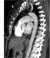 Examine the image below.The line points to the:   A)  stomach. B)  liver. C)  kidney. D)  heart.