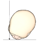 Identify the x-ray projection illustrated in this figure.   A)  Tangential B)  PA axial oblique. C)  Orbitoparietal D)  Parietoorbital