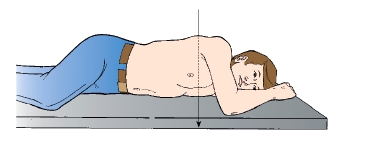 The patient in this figure is placed in which position?   A)  RPO B)  LPO C)  RAO D)  LAO