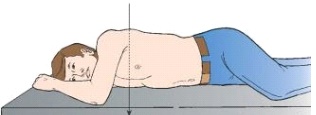 The body position depicted below results in which x-ray projection?   A)  PA oblique B)  AP oblique C)  Recumbent D)  Mediolateral