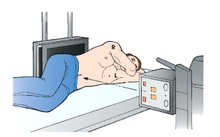 The x-ray projection shown in this figure is:   A)  AP. B)  PA. C)  right lateral. D)  right lateral decubitus.