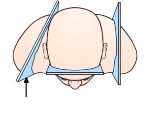 The plane indicated by the arrow in this figure is the:   A)  sagittal. B)  coronal. C)  oblique. D)  horizontal.