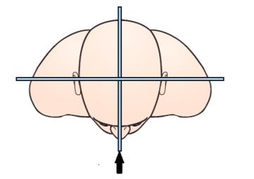 The body plane indicated by the arrow in this figure is the:   A)  midcoronal. B)  midsagittal. C)  horizontal. D)  transverse.