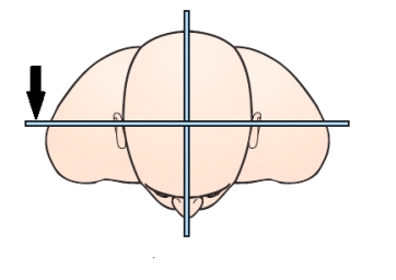The body plane indicated by the arrow in this figure is the:   A)  sagittal. B)  coronal. C)  midsagittal. D)  midcoronal.
