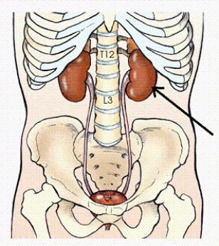 The organ identified in the figure below is the:   A)  spleen. B)  liver. C)  left kidney. D)  right kidney.