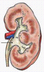 The area of the kidney identified in the figure below is the:   A)  hilum. B)  renal pelvis. C)  renal sinus. D)  minor calyx.
