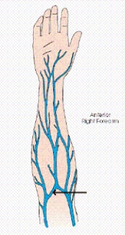 What vein,often used for venipuncture,is labeled with the arrow in the diagram below?   A)  Basilic vein B)  Cephalic vein C)  Radial vein D)  Median cubital vein