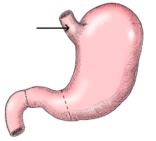 The area identified in the figure below is the:   A)  fundus. B)  angular notch. C)  cardiac antrum. D)  lesser curvature.