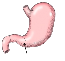 The part of the stomach identified in the figure below is the:   A)  greater curvature. B)  pyloric antrum. C)  pyloric canal. D)  pyloric sphincter.