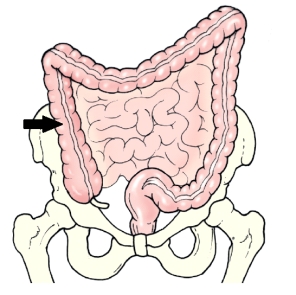 The area of the colon identified in the figure below is the:   A)  left colic flexure. B)  right colic flexure. C)  ascending colon. D)  descending colon.