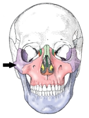 The bone indicated in the figure below is the:   A)  parietal. B)  orbital. C)  temporal. D)  zygoma.