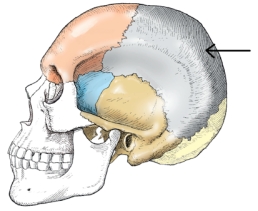 The bone indicated in the figure below is the:   A)  temporal. B)  parietal. C)  occipital. D)  sphenoid.