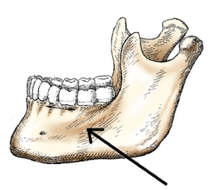The part of the mandible identified in the figure below is the:   A)  body. B)  ramus. C)  symphysis. D)  alveolar portion.
