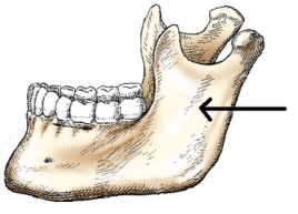 The portion of the mandible identified in the figure below is the:   A)  body. B)  ramus. C)  symphysis. D)  alveolar portion.