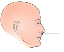 The landmark identified in the figure below is the:   A)  nasion. B)  glabella. C)  acanthion. D)  auricular point.